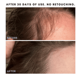 The Hair + Skin Boosting Bundle From Clover by Clove + Hallow