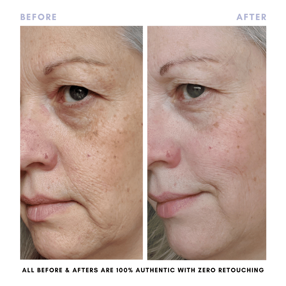 The Balancing Treatment Duo From Clover by Clove + Hallow