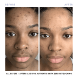 The Skin Reset Starter Kit From Clover by Clove + Hallow
