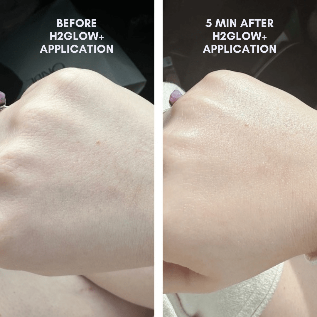 The Skin Reset Starter Kit From Clover by Clove + Hallow