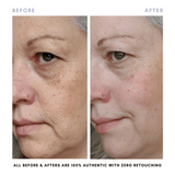The Skin Reset Starter Kit From Clover by Clove + Hallow
