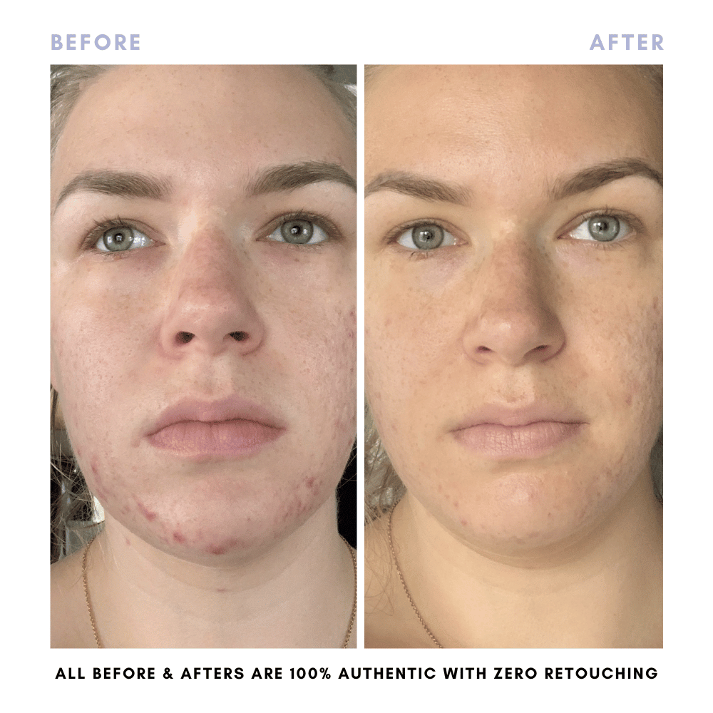 The Balanced Skin Set (Travel-Size) From Clover by Clove + Hallow