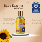 Eczema Relief Oil| Natural Soothing Solution for Eczema-Prone Skin From Kiyamel