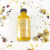 Super Acne Fighter / Organic Acne Treatment / Acne / Essential Oils / Natural  Acne Treatment / Acne Scars / Hormonal Acne / Cystic Acne From Butter Me Up Organics