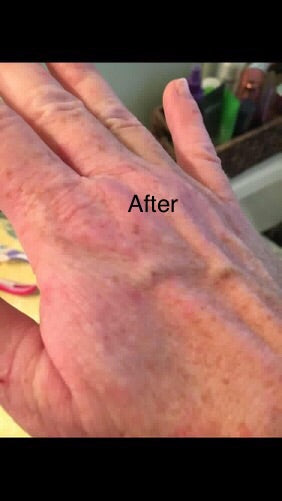 No More Eczema Organic Handmade Soap from Sweet Harvest Farms