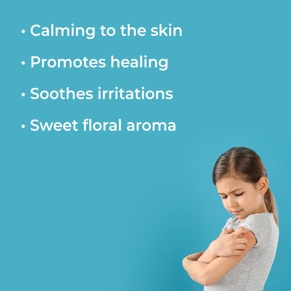 Itch Away Essential Oil from Plant Therapy