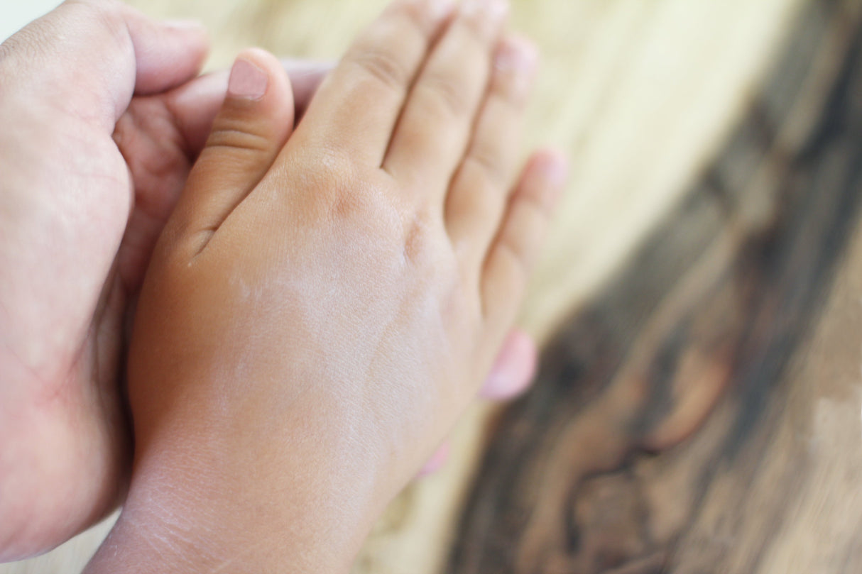 Magic Healer - A Salve that Heals Many Skin Conditions from Lucky Teeth