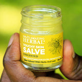 Touchy Skin Salve, Sensitive Skin & Eczema Salve from Ora's Amazing Herbal