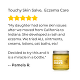 Touchy Skin Salve, Sensitive Skin & Eczema Salve from Ora's Amazing Herbal
