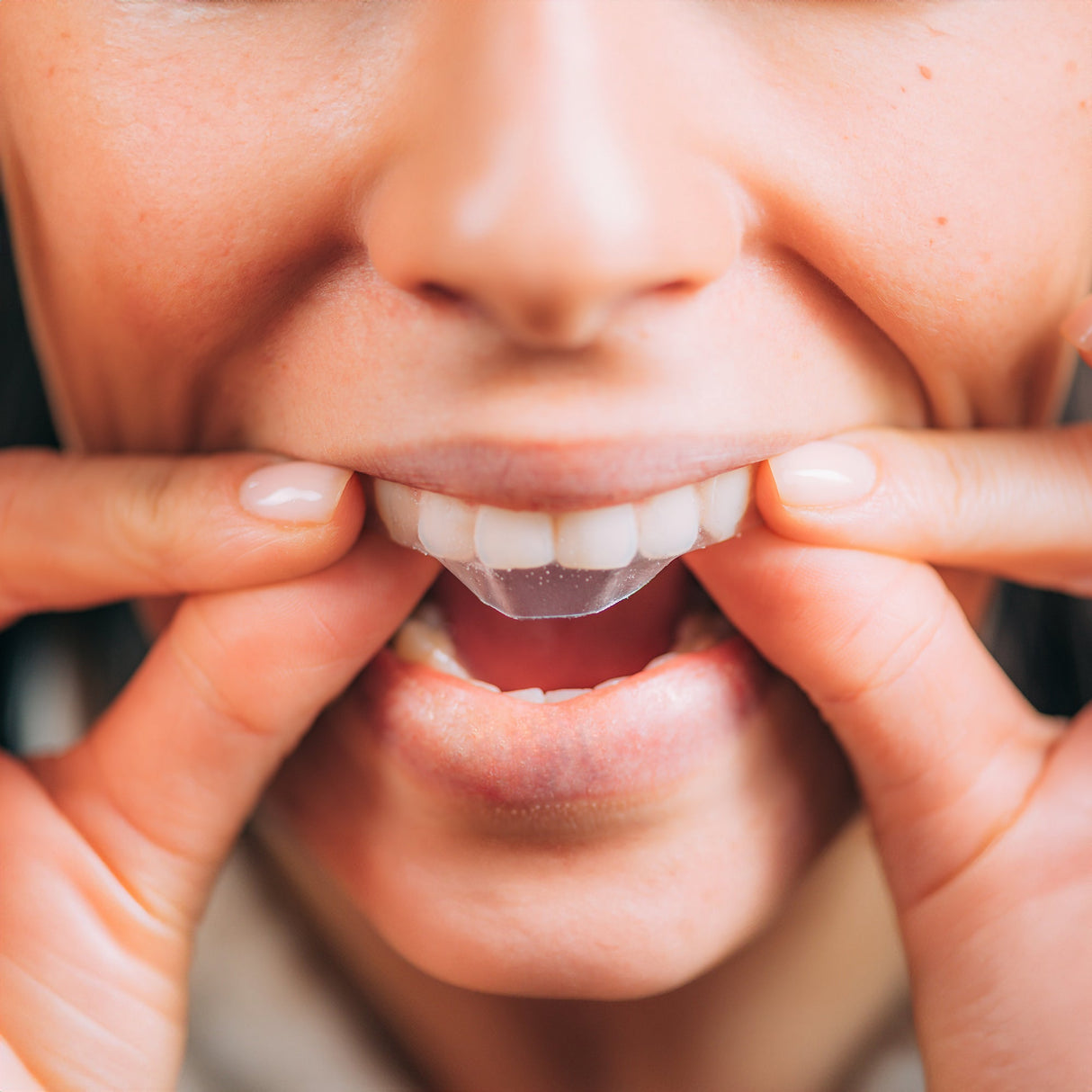 Professional Teeth Whitening Strips from Pursonic